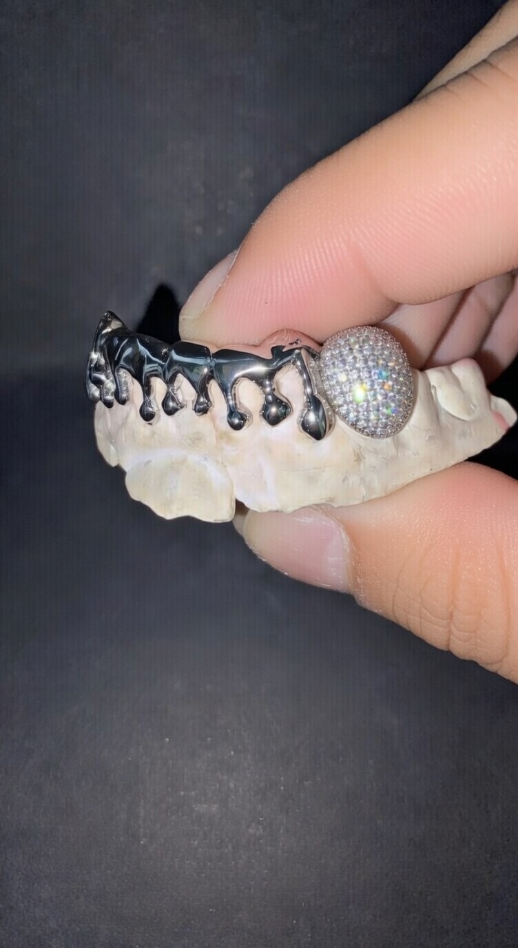 Grillz Personalizzati Divergent